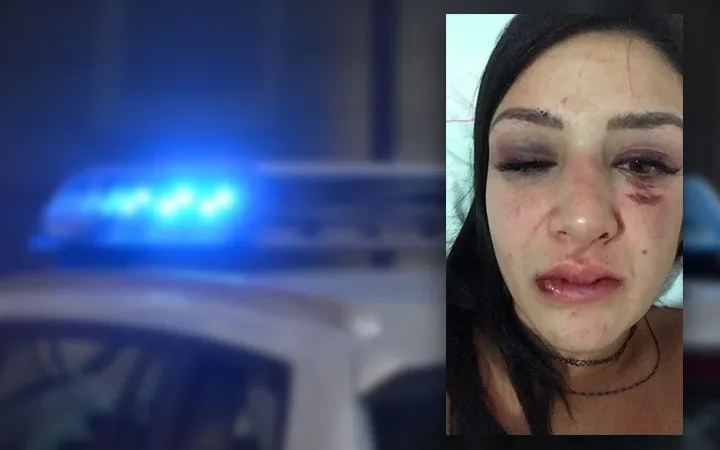 Jovem de Araranguá é espancada por namorado