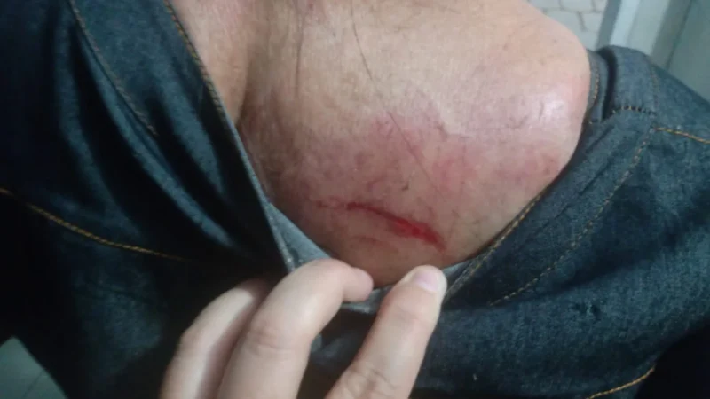 Ventania derruba relógio de rua sobre mulher em Araranguá