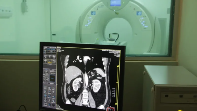 Medidas ágeis do Estado viabilizam retomada da tomografia no Hospital Celso Ramos antes do tempo previsto