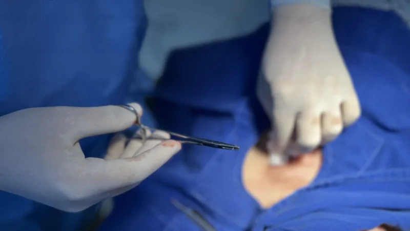 Hospital Santa Teresa promove mutirão de cirurgias para combater o câncer de pele