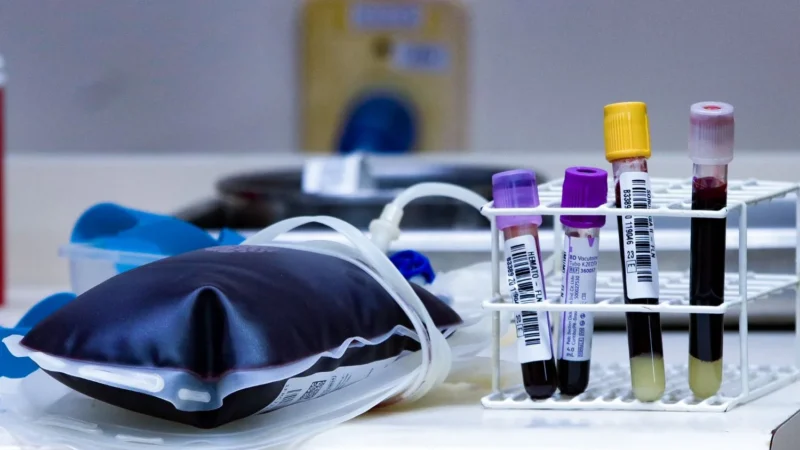 Dezembro Vermelho: Saúde reforça a prevenção e conscientização sobre o HIV/Aids