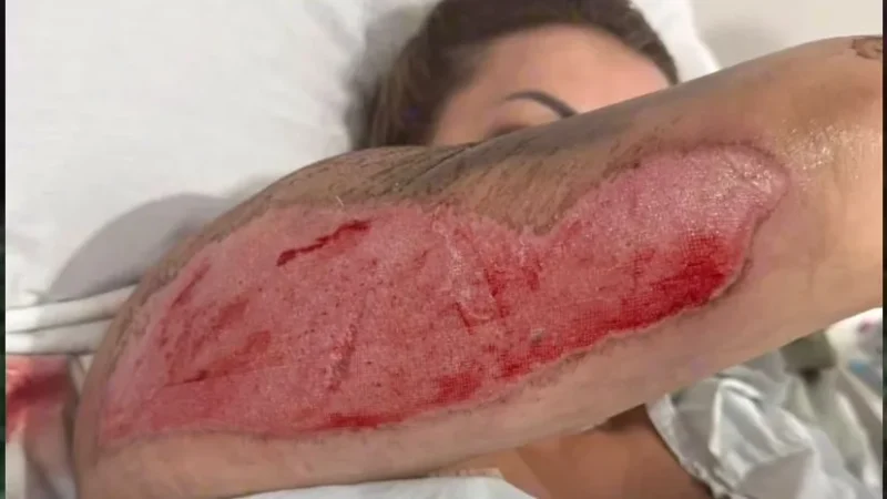 Vítima de atropelamento reage a prisão preventiva do acusado